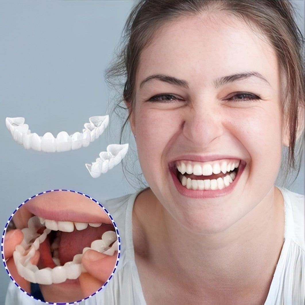 Velvaro Snap-On Smile Veneers
