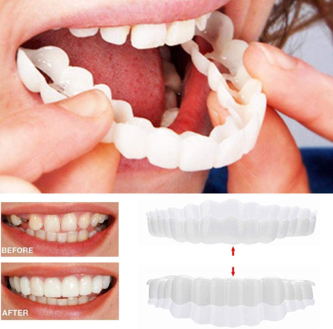Velvaro Snap-On Smile Veneers
