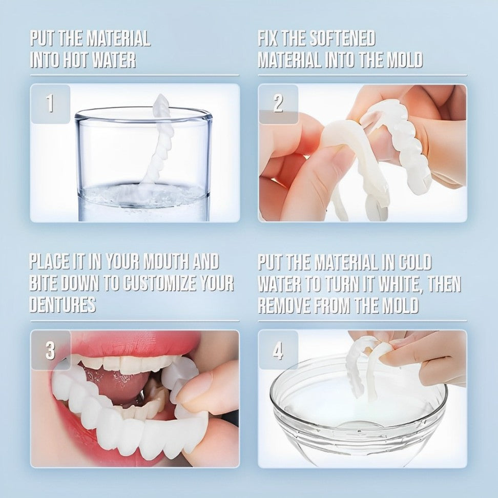 Velvaro Snap-On Smile Veneers
