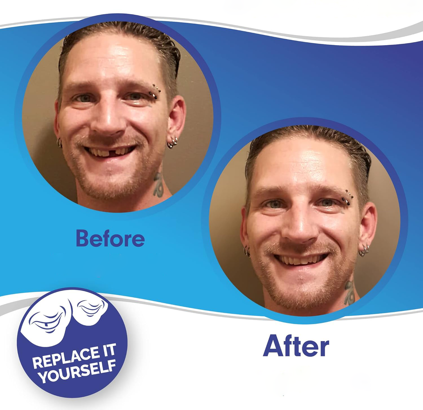 Velvaro Snap-On Smile Veneers