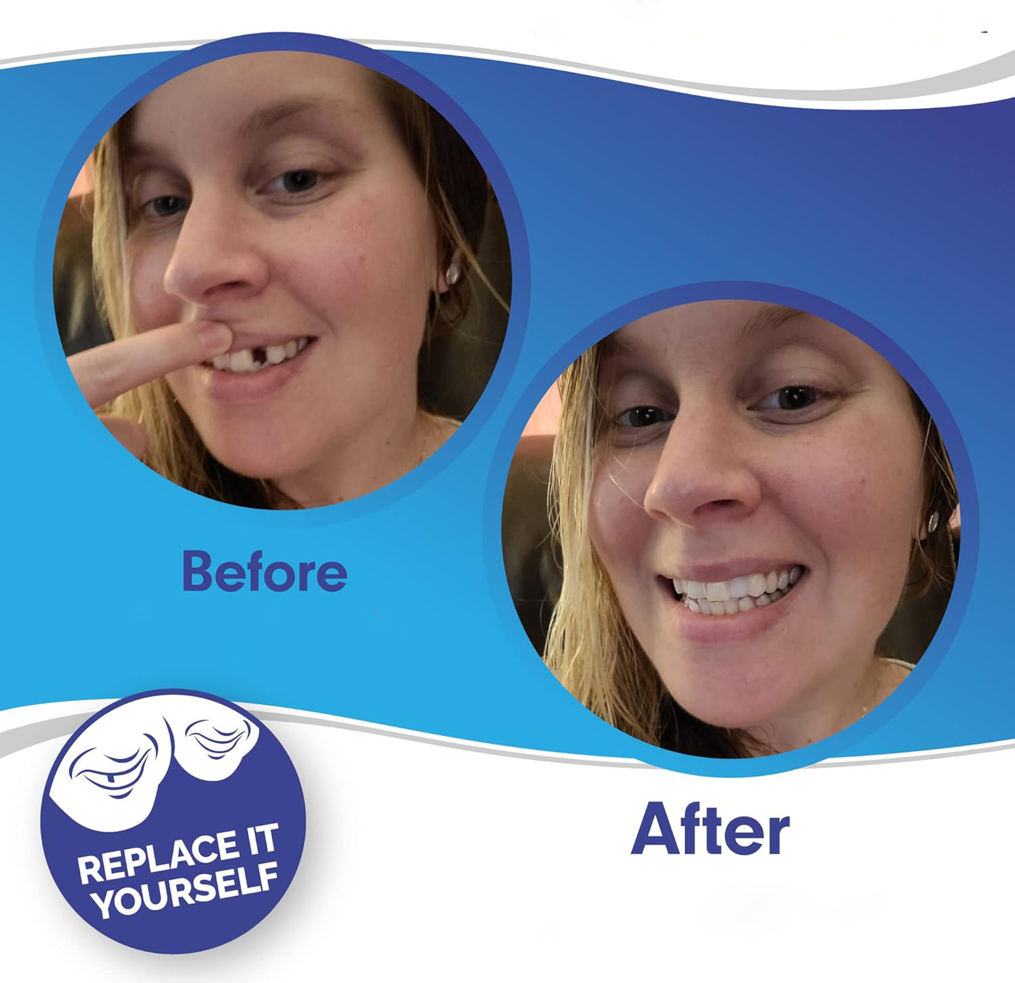 Velvaro Snap-On Smile Veneers