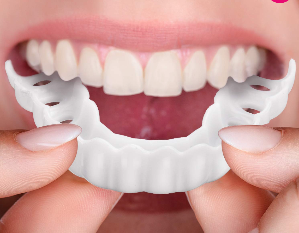 Velvaro Adjustable Snap-On Dentures
