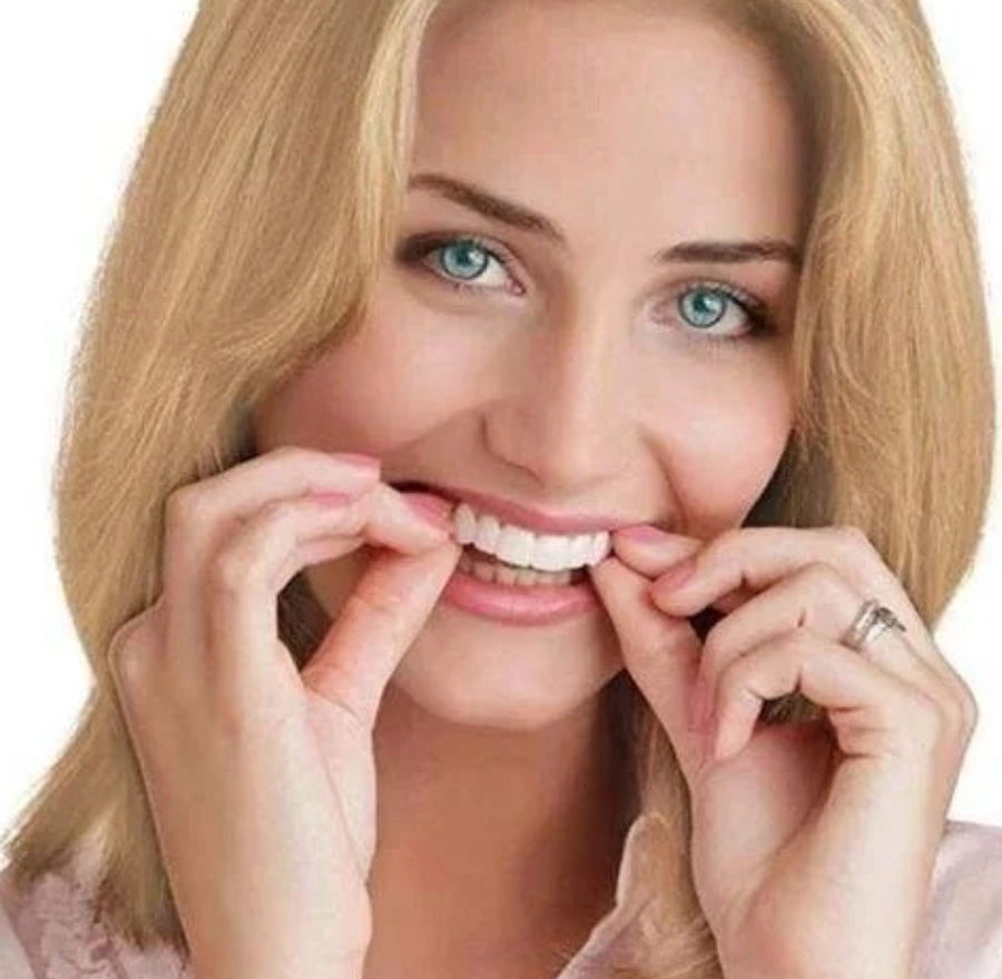 Velvaro Adjustable Snap-On Dentures