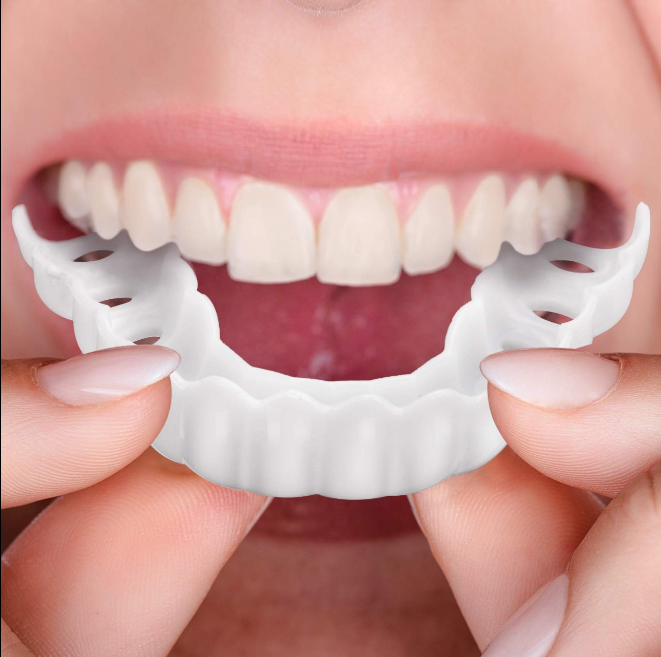 Velvaro Adjustable Snap-On Dentures