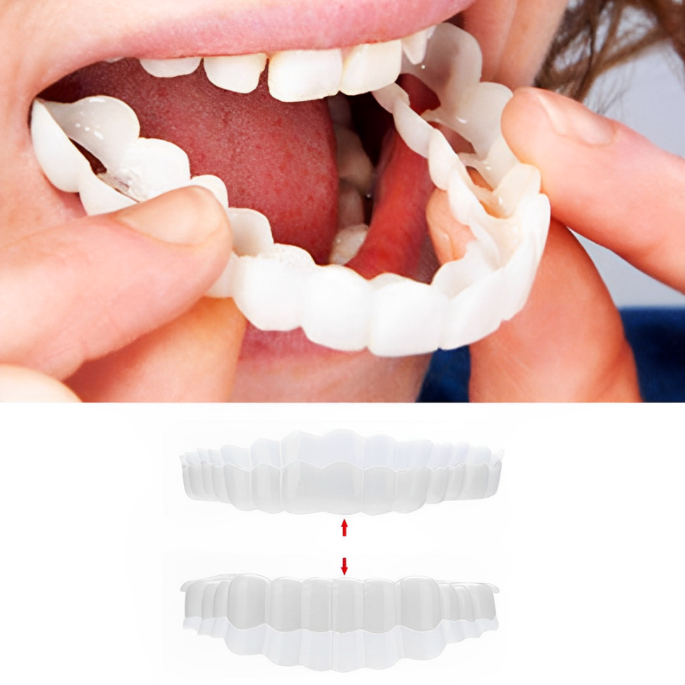 Velvaro Snap-On Smile Veneers
