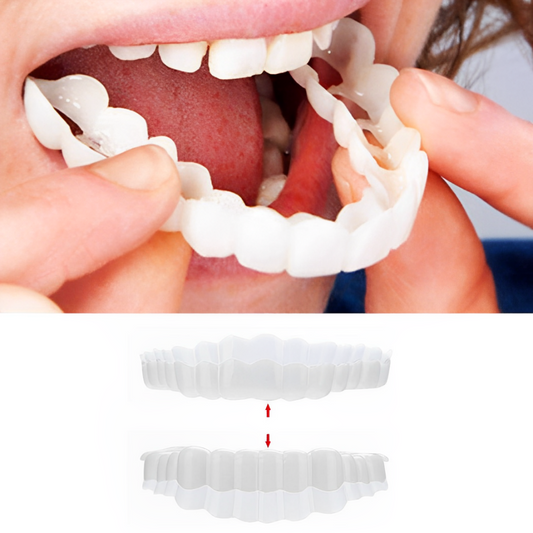 Velvaro Snap-On Smile Veneers