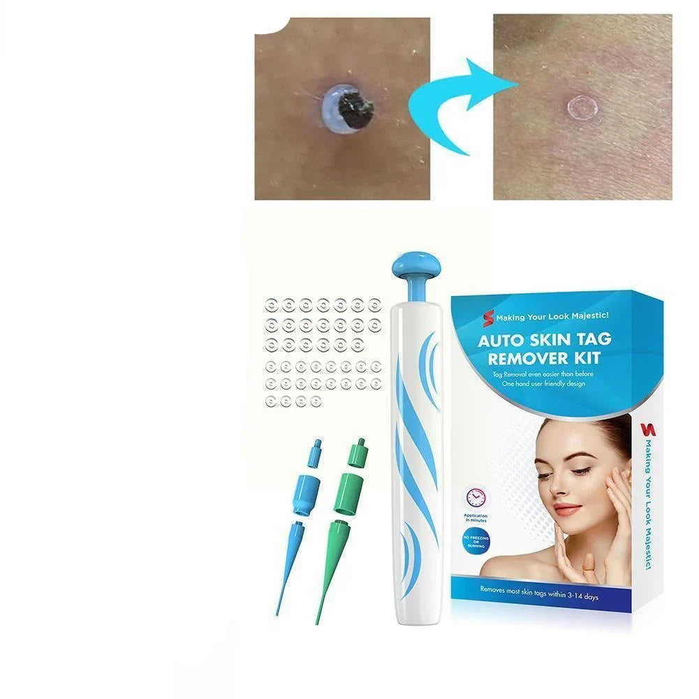 Velvaro Auto Skin Tag Remover Pen