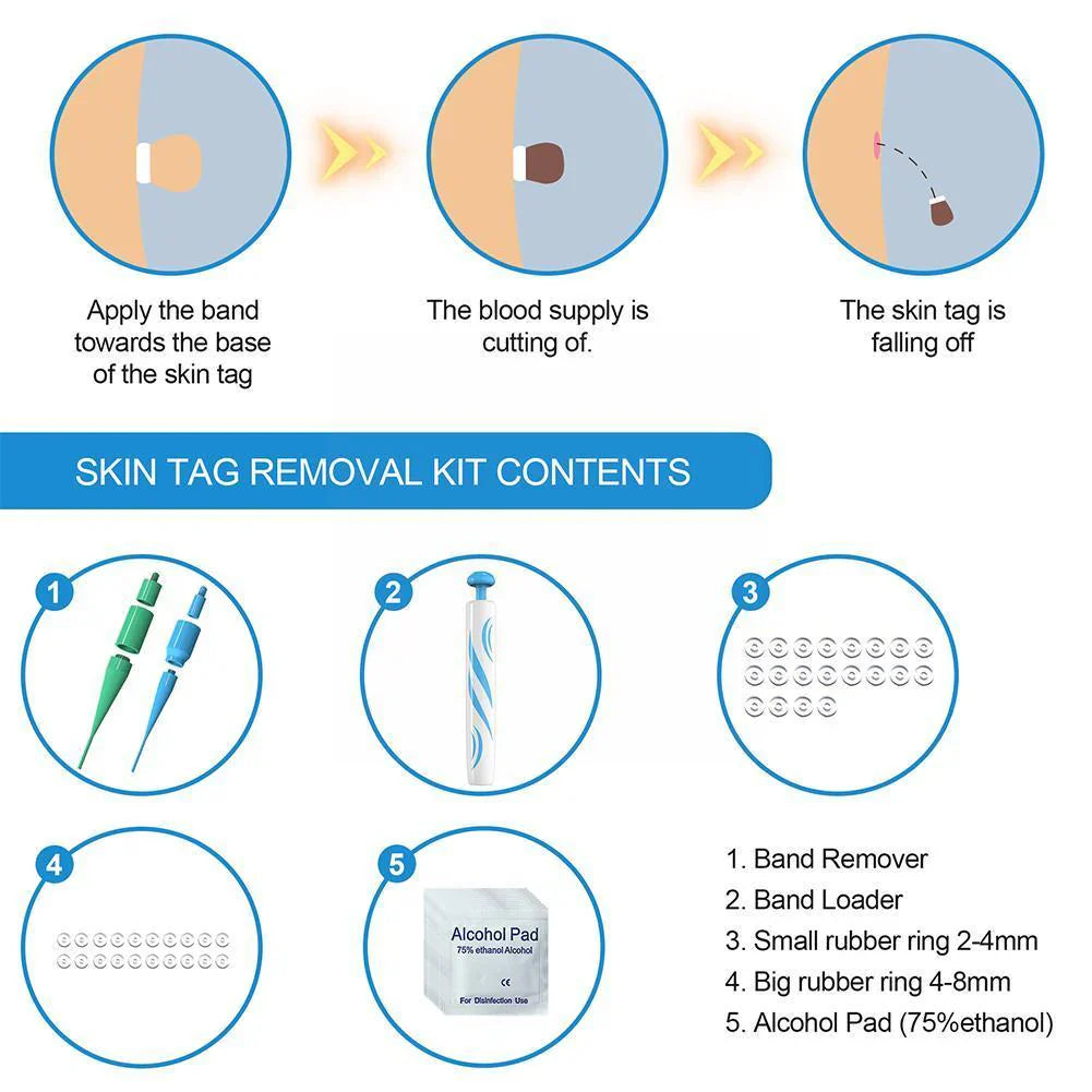 Velvaro Auto Skin Tag Remover Pen
