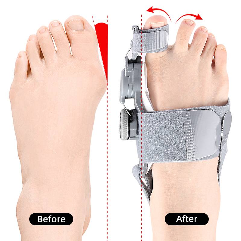 Velvaro Natural Bunion Corrector Toe Spacer