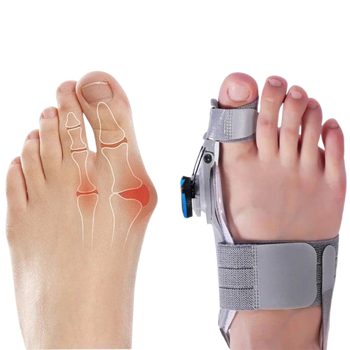 Velvaro Natural Bunion Corrector Toe Spacer