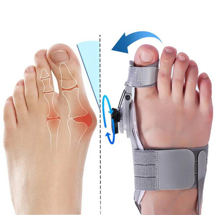 Velvaro Natural Bunion Corrector Toe Spacer